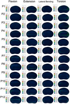 The effects of cage on endplate collapse after stand-alone OLIF: based on finite element analysis and in vitro mechanics experiments